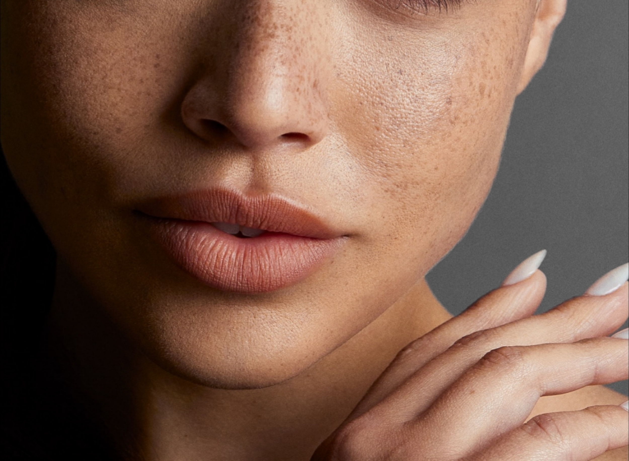 Treating Vascular Occlusion in the Chin - Aesthetics Journal